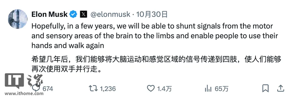 马斯克公布 Neuralink 脑机新产品进展:第二款产品“盲视”只待监管批准