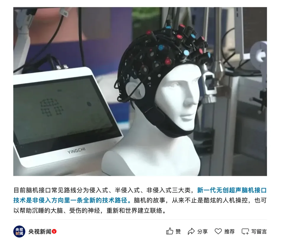 新一代无创超声脑机接口亮相:无需开颅,持续 4 周干预有望唤醒“植物人”